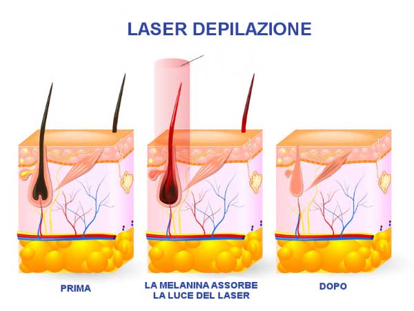 Il ciclo vitale del pelo - epilazione laser